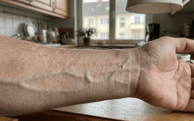 Warum sichtbare Venen plötzlich überall diskutiert werden