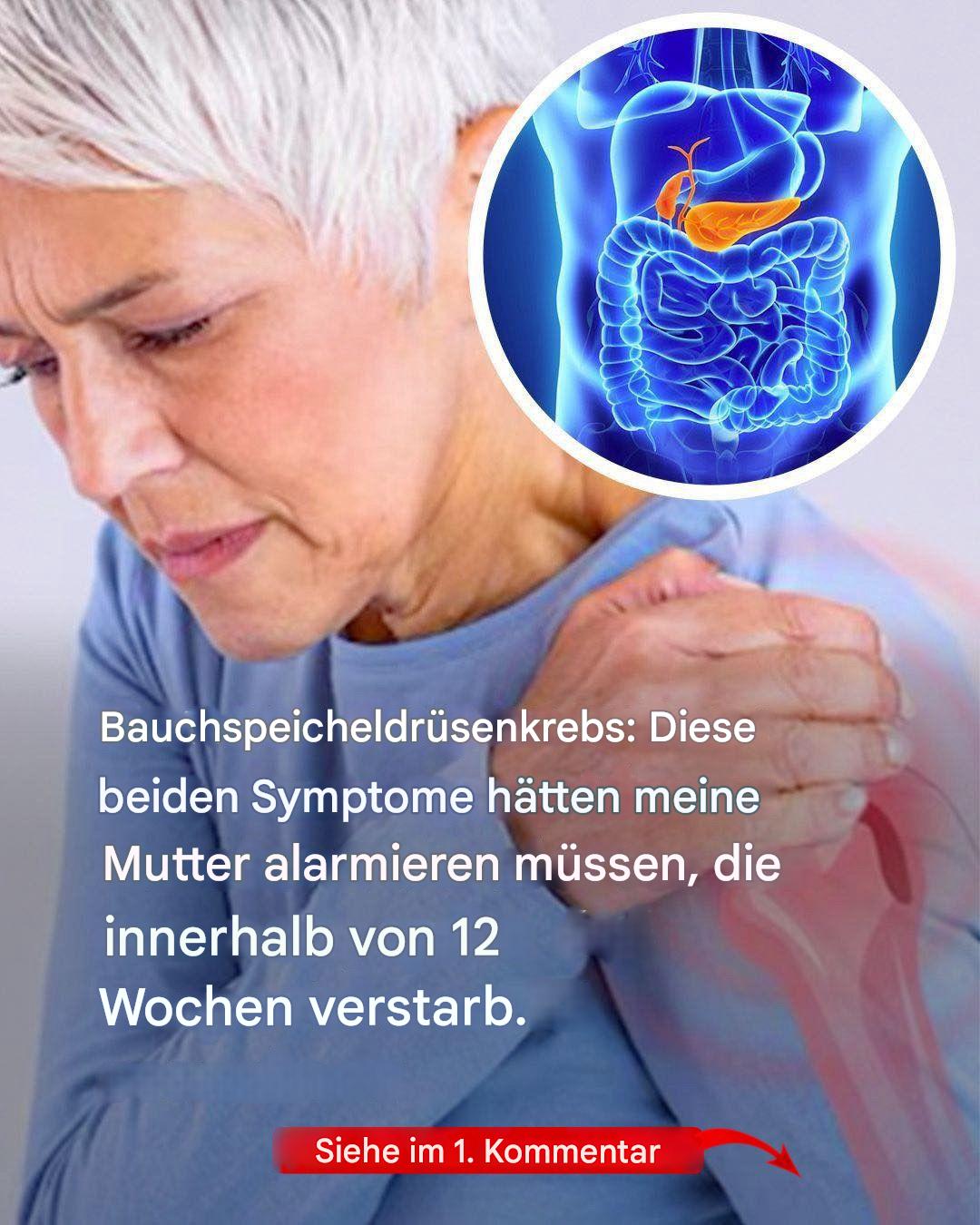 Bauchspeicheldrüsenkrebs: die zwei frühen Symptome, die meine Mutter hätten retten können