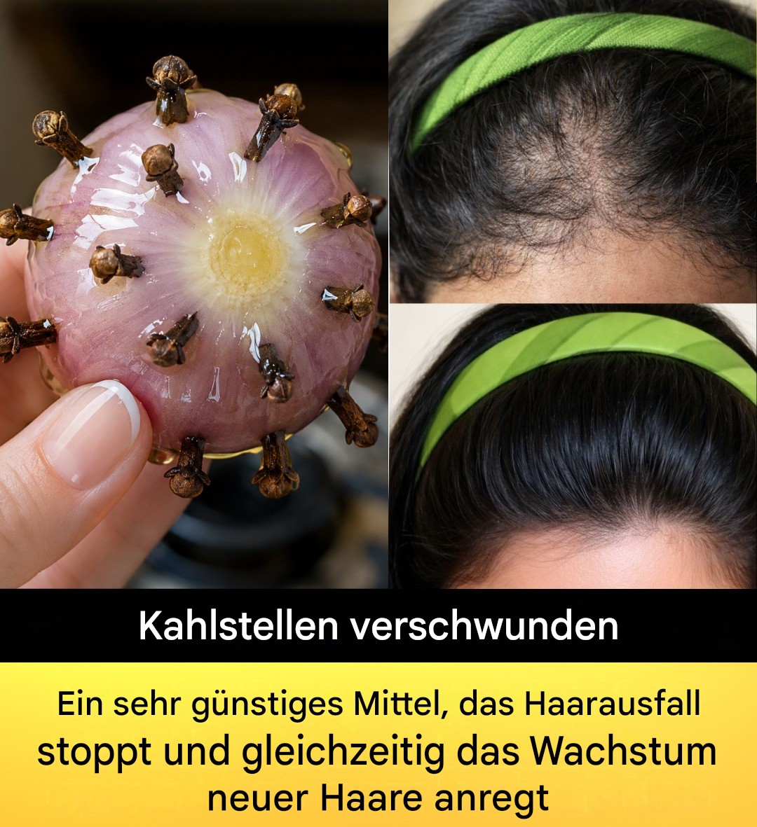 Die 3 besten Haaröle: Gegen Haarausfall, für dickeres Haar, extremes Haarwachstum