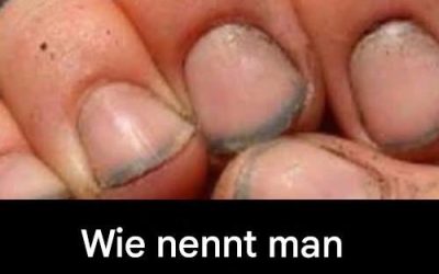 Wie nennt man jemanden mit solchen Nägeln?