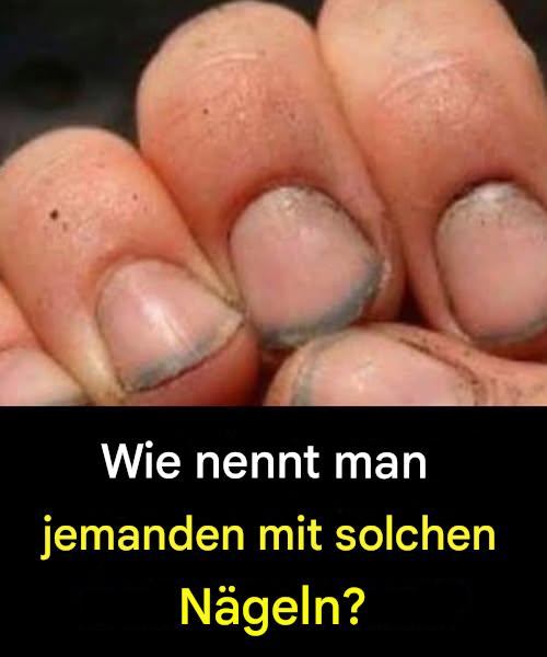 Wie nennt man jemanden mit solchen Nägeln?