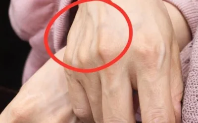 Wenn Sie sichtbare Venen haben, bedeutet das, dass Sie… sind?