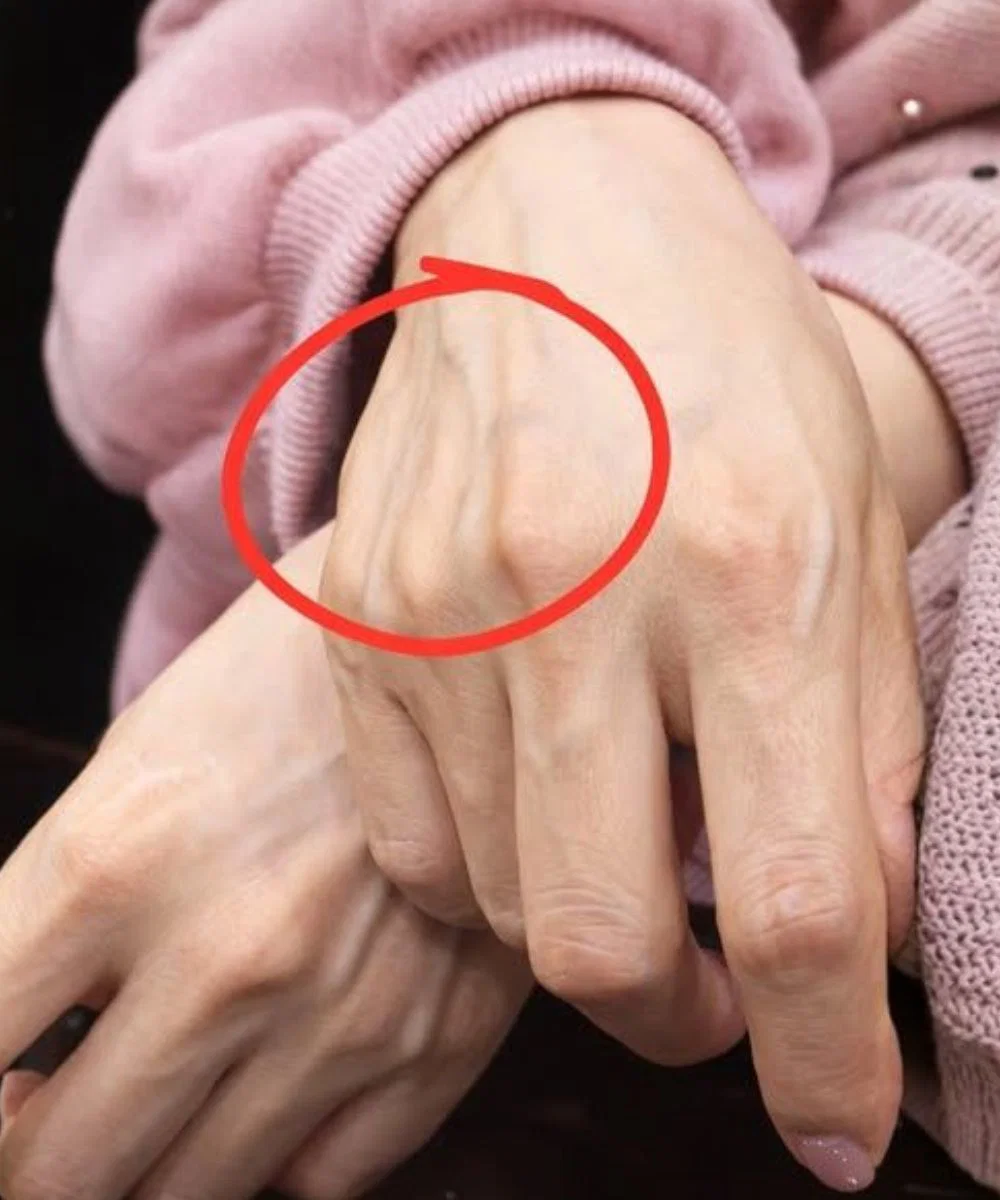 Wenn Sie sichtbare Venen haben, bedeutet das, dass Sie… sind?